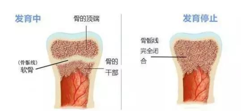 你家孩子又長高了嗎？