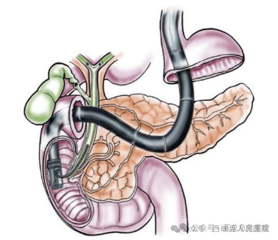 報(bào)喜了01