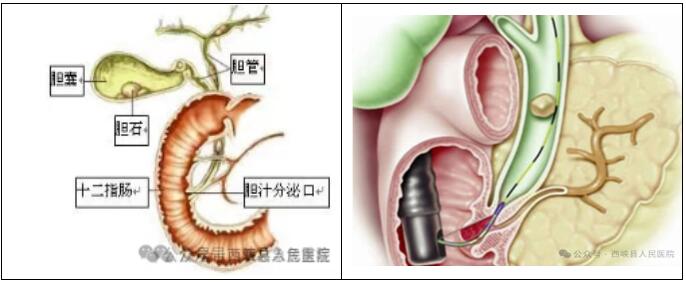 報(bào)喜了01