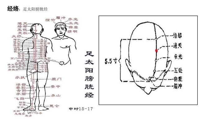 通天穴：主治頭痛，眩暈，鼻塞，鼻衄，鼻淵