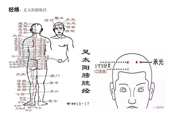 承光穴：主治頭痛、目眩、癲癇